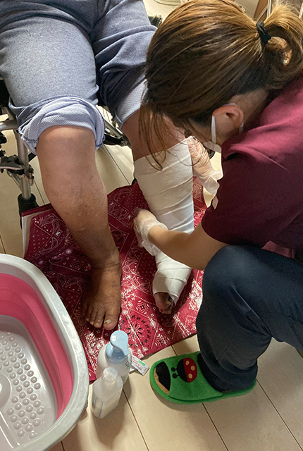障害のある患者様の褥瘡処置